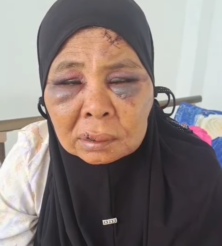 lbh-kecam-diduga-pekerja-tambang-ilegal-yang-aniaya-nenek-di-pasaman